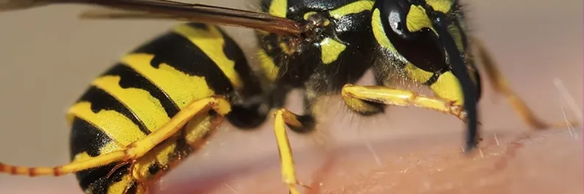 wasp-stinging-Myrtle-Beach.jpg